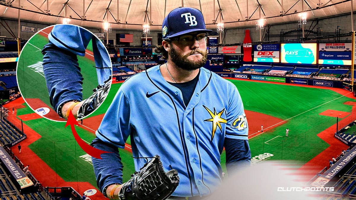 Rays pitching staff dealt another injury blow