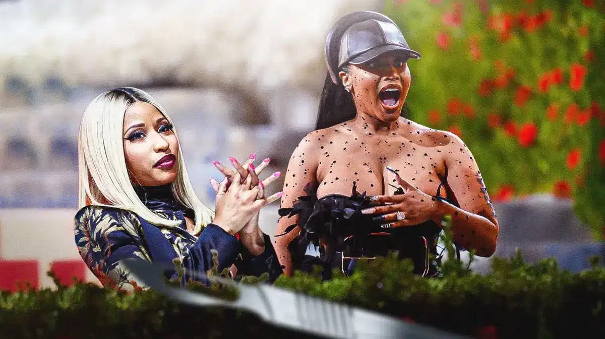 Nicki Minaj's critical realization it was time for surgery