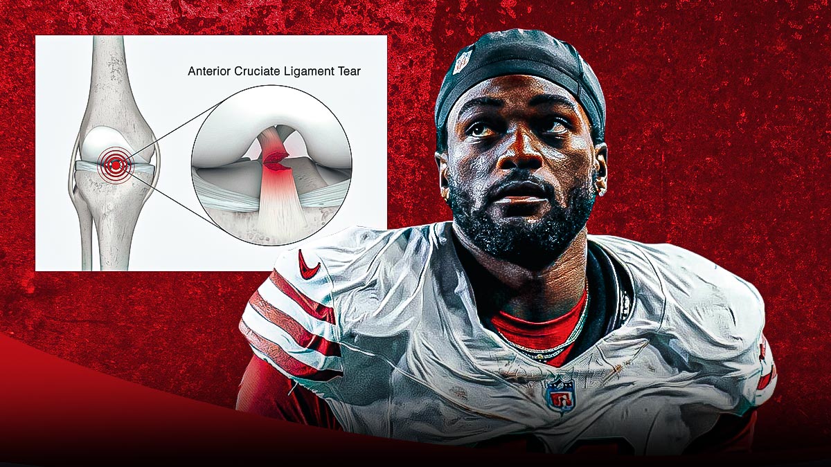49ers WR Brandon Aiyuk and a torn ACL diagram