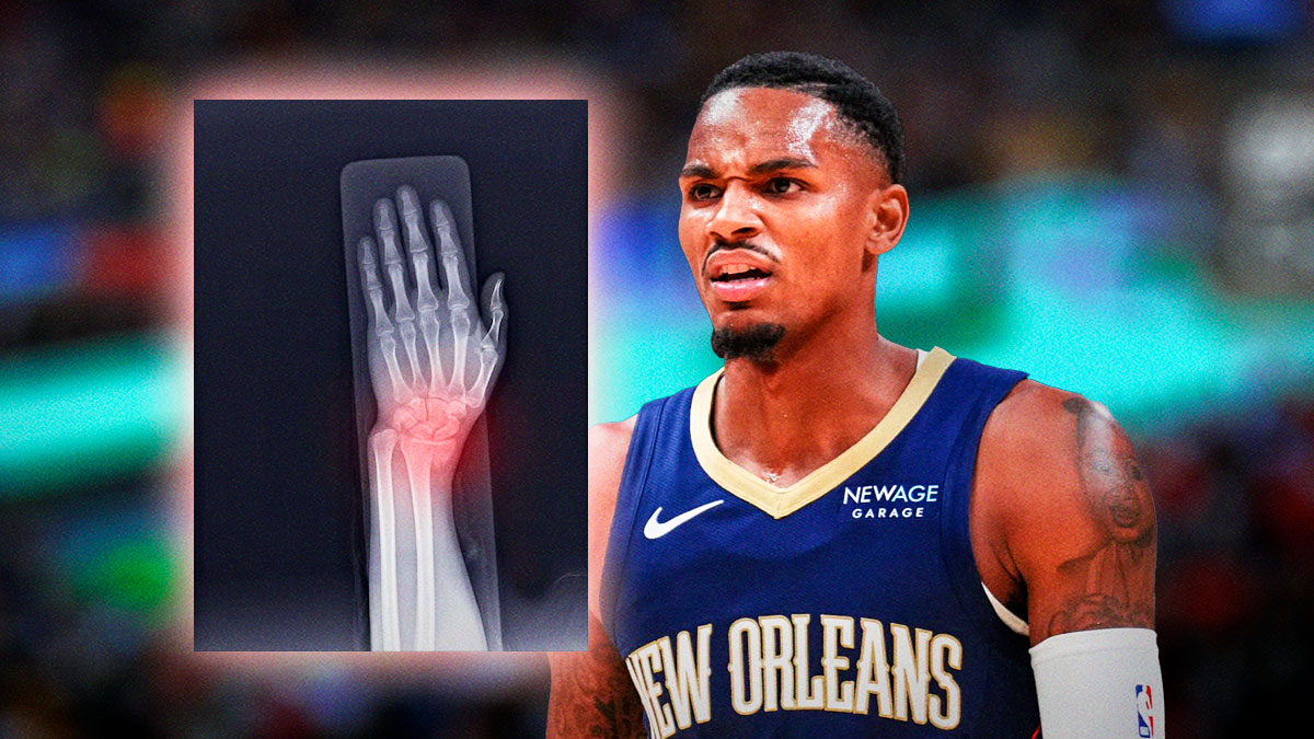 Pelicans' Dejounte Murray looking disappointed, with X-ray of a broken hand beside him