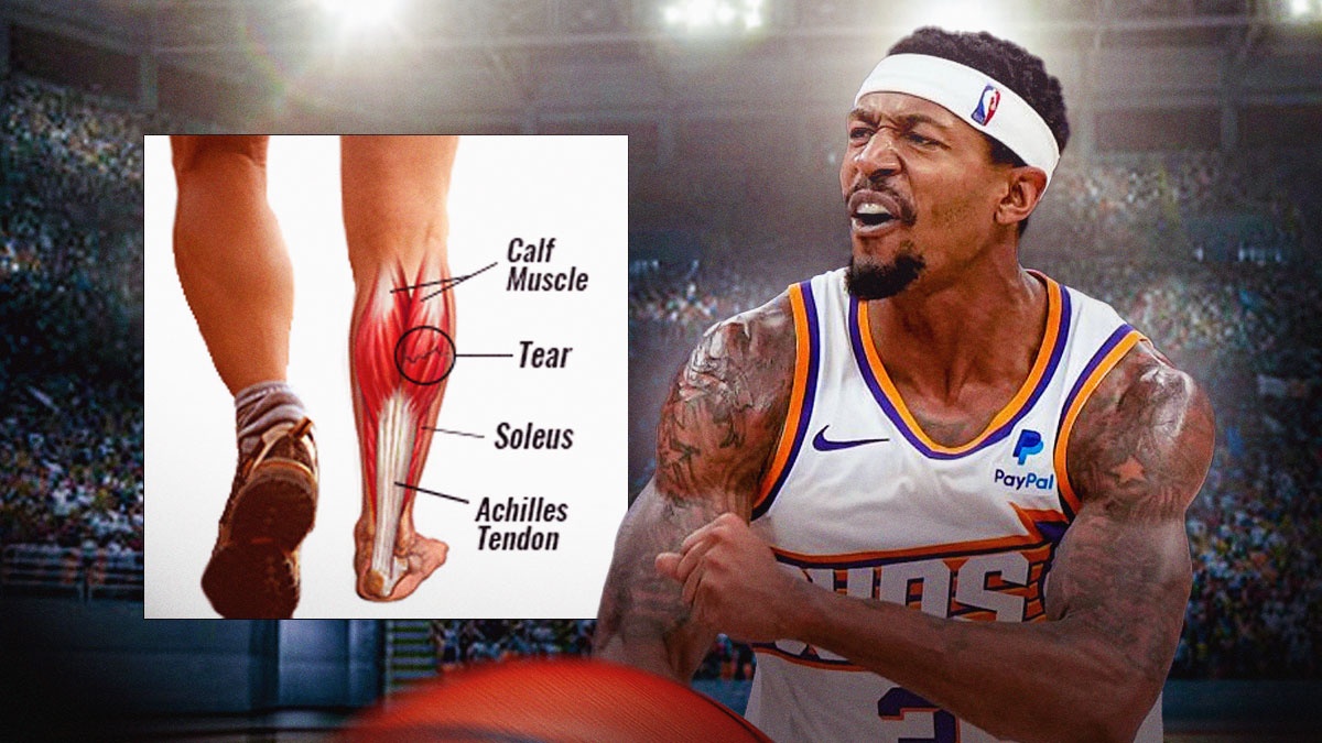 Suns' Bradley Beal looking pissed off, with diagram of calf muscle injury beside him