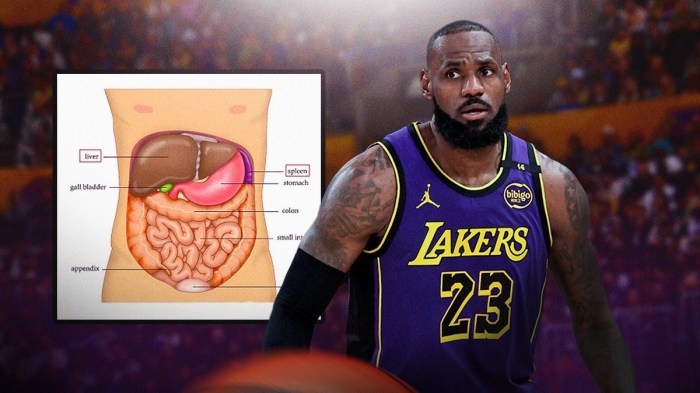 Lakers' LeBron James looking worried, with diagram of abdominal injury beside him