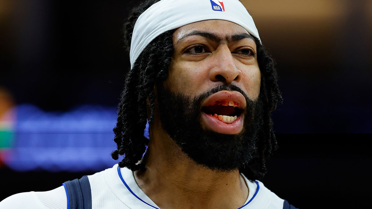 Dallas Mavericks forward Anthony Davis (3) bleeds from the mouth after a play during the fourth quarter against the Sacramento Kings at Golden 1 Center.