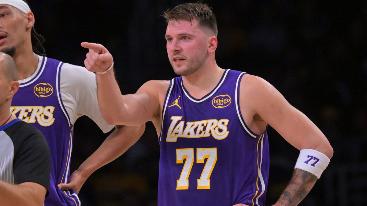 Lakers guard Luka Doncic (77) reacts after he was poked in the eye during the first half against the San Antonio Spurs at Crypto.com Arena