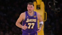 Los Angeles Lakers guard Luka Doncic (77) reacts after he was poked in the eye during the first half against the San Antonio Spurs at Crypto.com Arena.