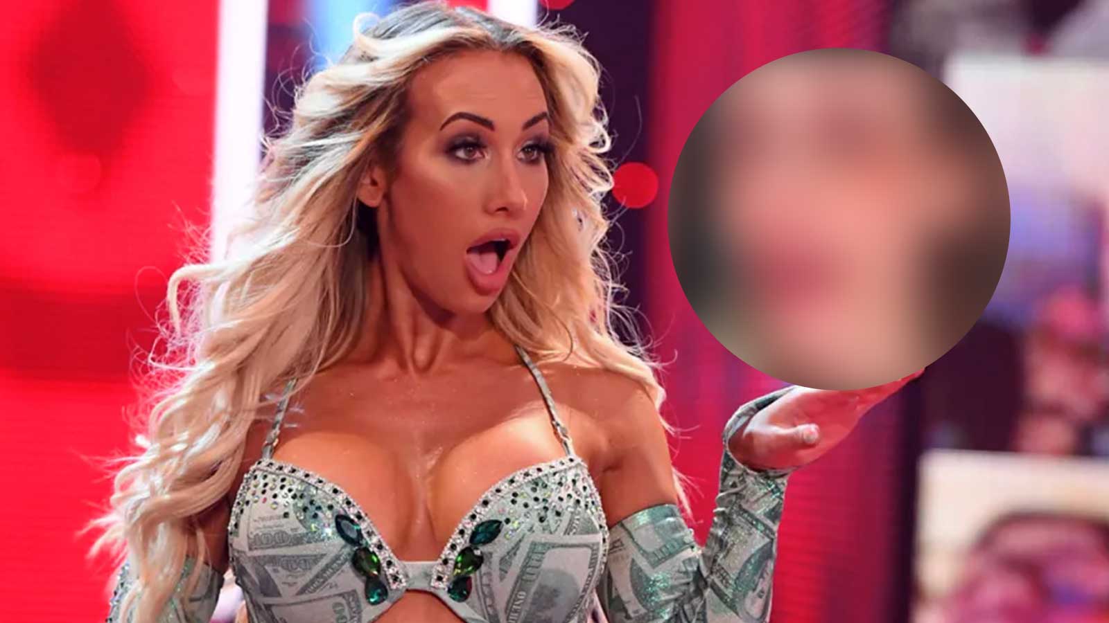 Graphic warning: Ex-WWE Star Carmella shares first picture since eye surgery