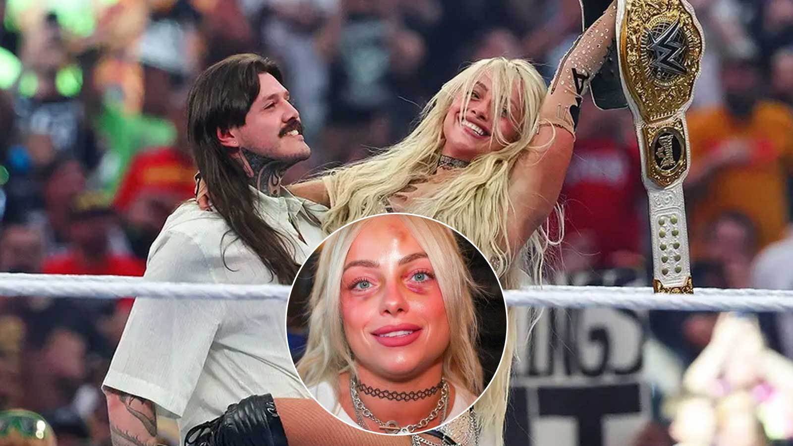 Liv Morgan recalls suffering hematoma injury before WrestleMania 42