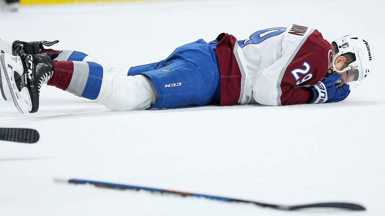 Avalanche coach Jared Bednar drops bar on Nathan MacKinnon possibly playing through broken face