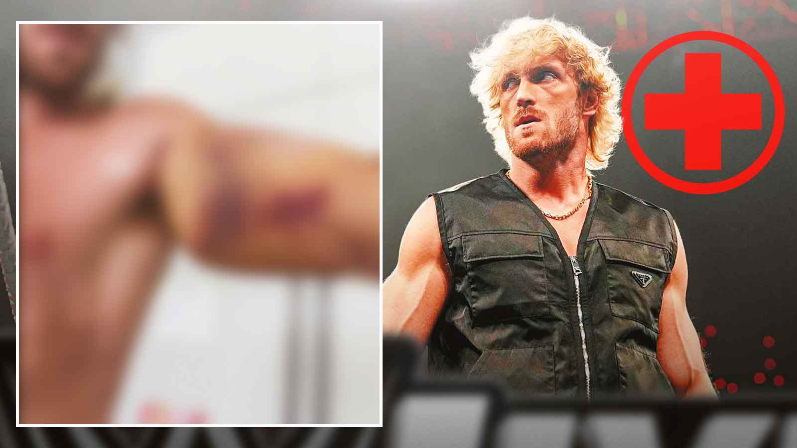 Graphic warning: WWE's Logan Paul shares grotesque look at torn tricep injury